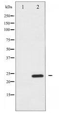BIK Antibody