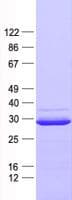 Human SCO2 Protein (Recombinant His, N-Terminal)
