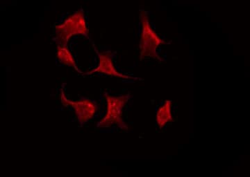 Polyclonal Rabbit anti-Human STK11 / LKB1 Antibody (IHC, IF, WB)