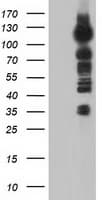 ERIC-1 / TACC3 Antibody (clone OTI1E8)
