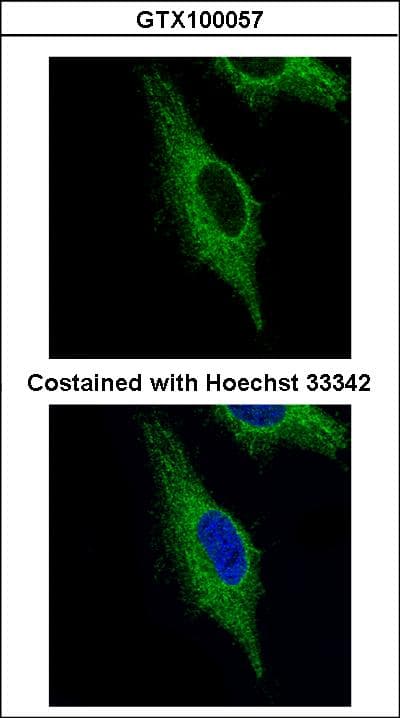 TRIM23 Antibody (aa1-44)