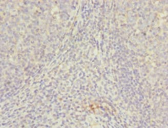 Polyclonal Rabbit anti-Human NUDT2 Antibody (IHC)