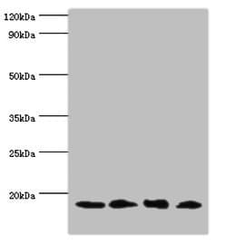 IHC-plus™ MMS2 / UBE2V2 Antibody (aa1-145)