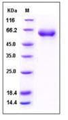 Human IL2RB / CD122 Protein (Recombinant Human IgG Fc, C-terminus)