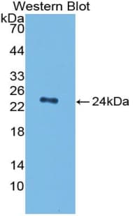 PLAT / TPA Antibody (aa311-487, APC)