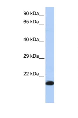GPX4 / MCSP Antibody (aa72-121)