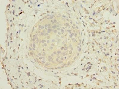 ZHX1 Antibody