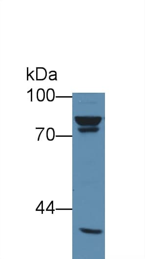 PathPlus™ Vimentin Antibody