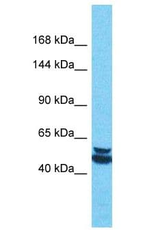 PALMD Antibody (aa441-490)