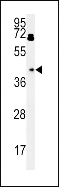 Polyclonal Rabbit anti-Human PDHA1 / PDH E1 Alpha Antibody (aa228-255, WB)