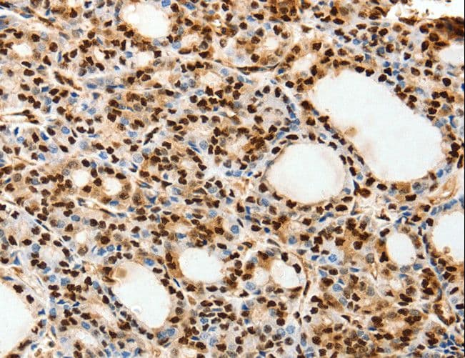 SPATA20 Antibody