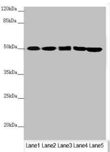 EF1G / EEF1G Antibody