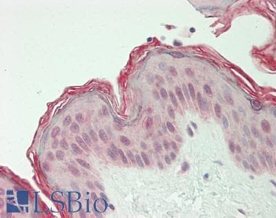 GLTSCR1 Antibody (aa1189-1238)