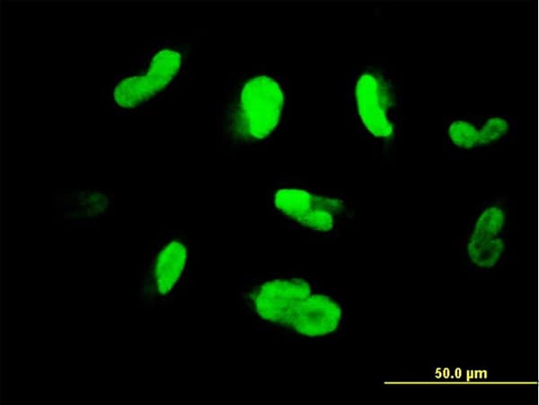 Monoclonal Mouse anti-Human MAK Antibody (clone 3E5, IF, WB)