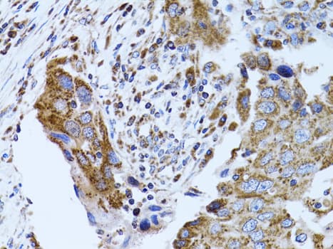 Polyclonal Rabbit anti-Human FABP4 / AP2 Antibody (IHC, IF, WB)