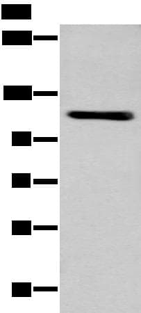 ZNF281 / Zfp281 Antibody