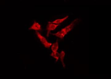 MTA1 Antibody
