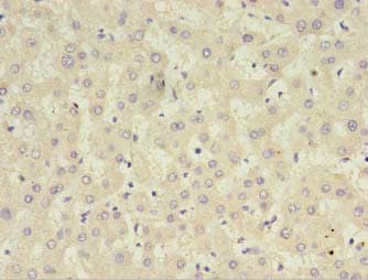 Polyclonal Rabbit anti-Human CFHR2 Antibody (IHC, WB)