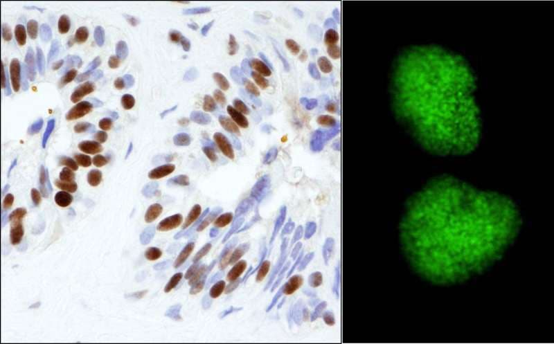TRIM28 / KAP1 Antibody (aa1-50)
