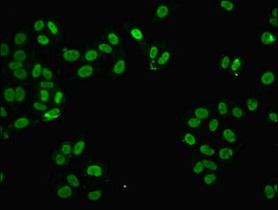 IHC-plus™ FUS / TLS Antibody