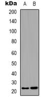Polyclonal Rabbit anti-Human BCAS4 Antibody (Internal, IHC, WB)