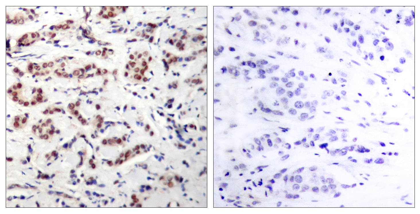 Polyclonal Rabbit anti-Human STAT5 A+B Antibody (phospho-Tyr694, IHC, WB)