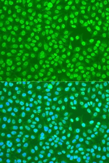 HNRNPDL / hnRNP D Antibody