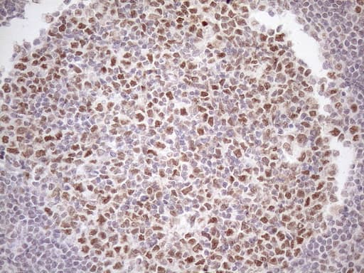 ATF1 Antibody (clone OTI2B4)