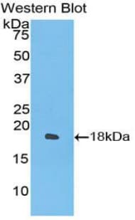 IFN Gamma / Interferon Gamma Antibody (aa24-166, PE)