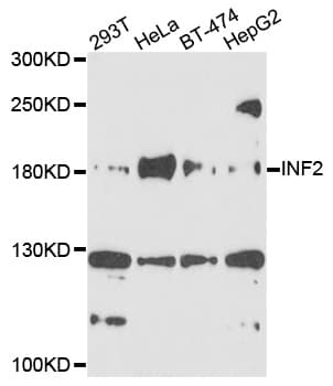 Polyclonal Rabbit anti-Human INF2 Antibody (WB)
