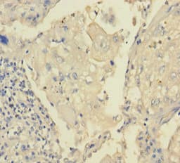 Polyclonal Rabbit anti-Human TRPM8 Antibody