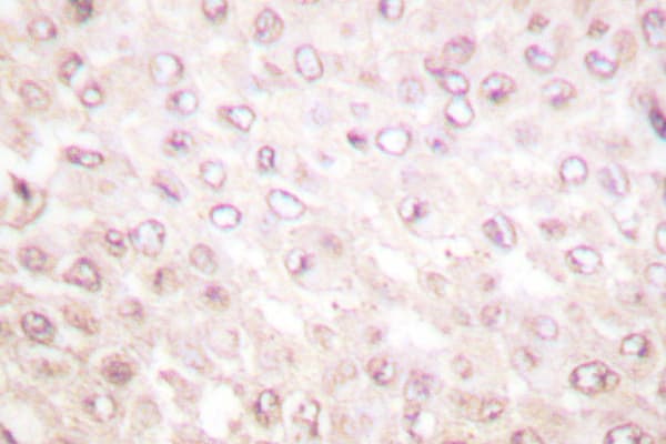 CSTB / Cystatin B / Stefin B Antibody (Asn84)