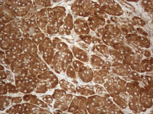 VAP33 / VAPA Antibody (aa2-227, clone OTI10E10)