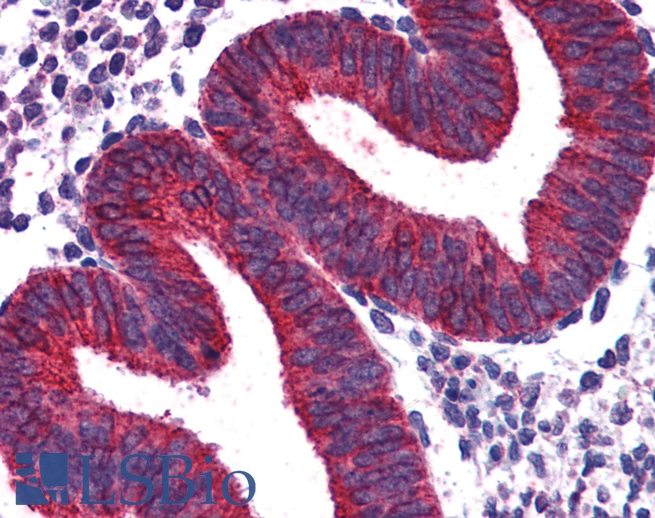 IHC-plus™ Polyclonal Goat anti-Human VPS29 Antibody (aa40-54, IHC)