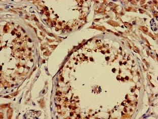 NLGN1 / Neuroligin 1 Antibody