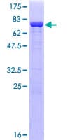 Human CDC37 Protein (Recombinant GST)