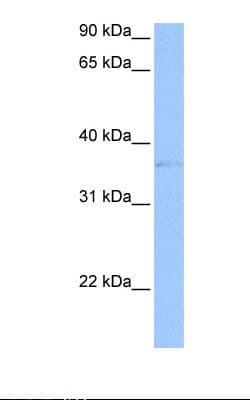 TLT2 / TREML2 Antibody (aa188-237)