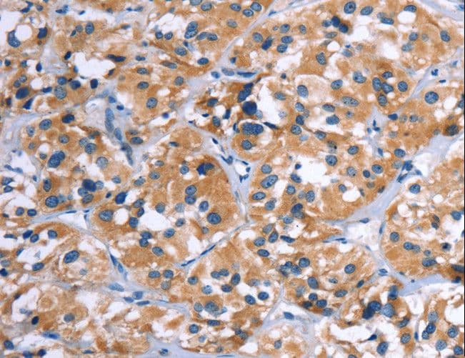 COMP / THBS5 Antibody