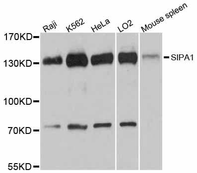 SIPA1 Antibody