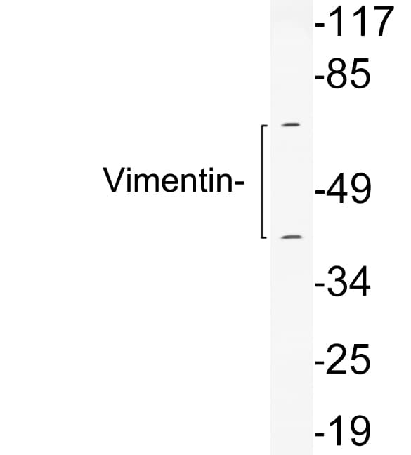 Polyclonal Rabbit anti-Human Vimentin Antibody (aa38-87, WB)