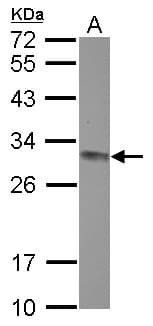 CLPP Antibody