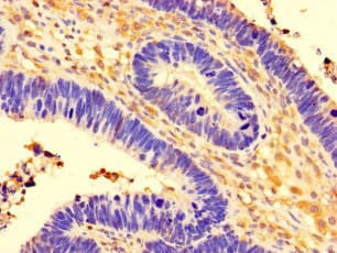 CCDC91 Antibody (Coiled-coil domain)