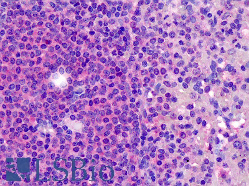 IHC-plus™ RP105 / CD180 Antibody