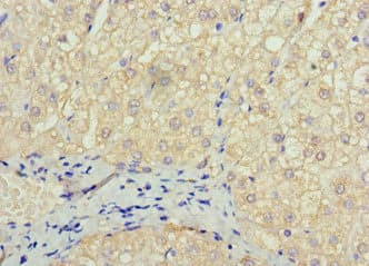 Polyclonal Rabbit anti-Human SOX14 Antibody (IHC, IF, WB)