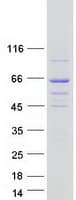 Human DENND6B Protein (Recombinant Myc-DDK (Flag))