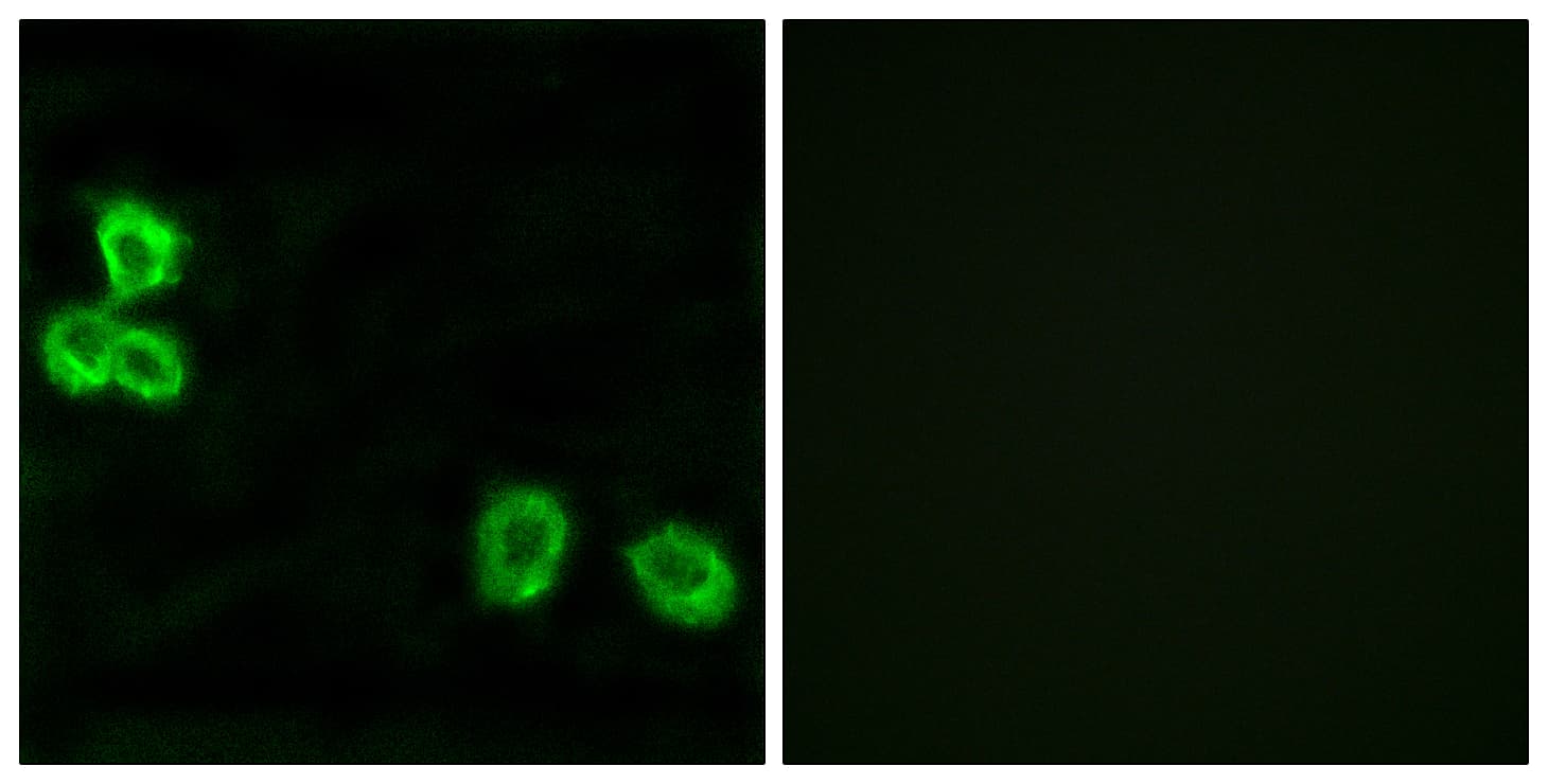 Polyclonal Rabbit anti-Human ADGRB1 / BAI1 Antibody (aa691-740, IHC, IF, WB)