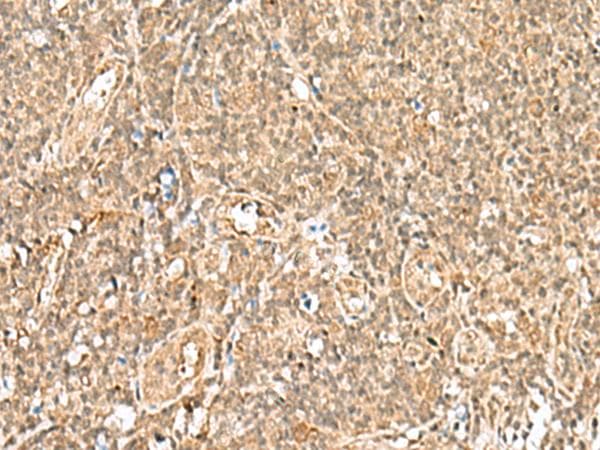 Polyclonal Rabbit anti-Human GTF2A2 / TFIIA Antibody (IHC)