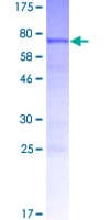 Human POLDIP3 / p46 Protein (Recombinant GST)