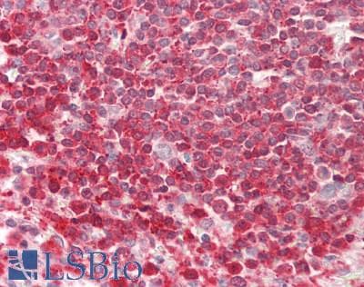 PFN1 / Profilin 1 Antibody (N-Terminus)