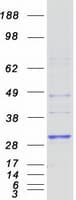 Human HLA-DRB4 Protein (Recombinant Myc-DDK (Flag))